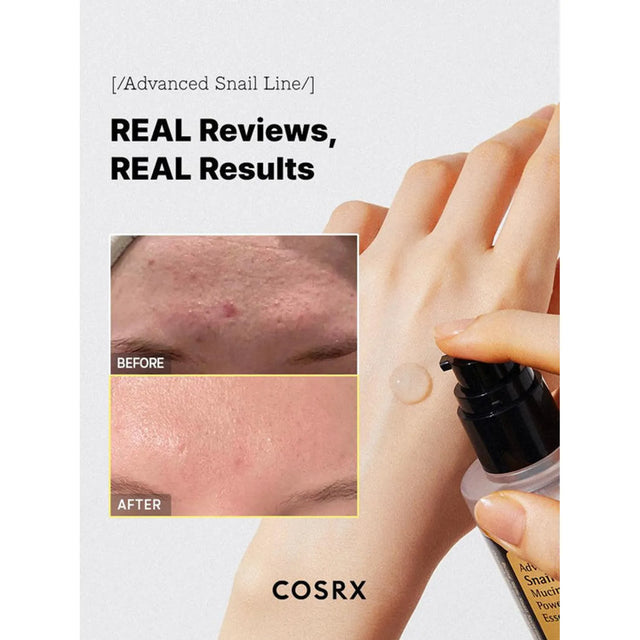 COSRX Advanced Snail 96 Mucin Power Essence 100 mL