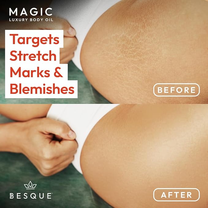 Magic Luxury Body Oil – Deep Hydration & Radiant Glow firming, hydrates